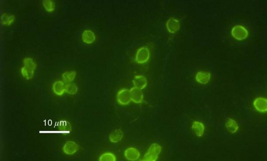 Immunofluorescence image of C. parvum oocysts.